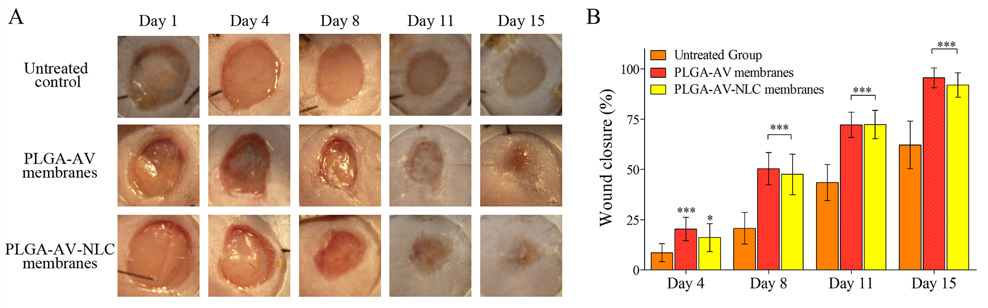In vivo wound closure. (A) Wounds photographs of each group on days 1, 4, 8, 11 and 15. (B) Wound closure represented as the percentage of reduction of the initial area on days 4, 8, 11 and 15 postinjury.