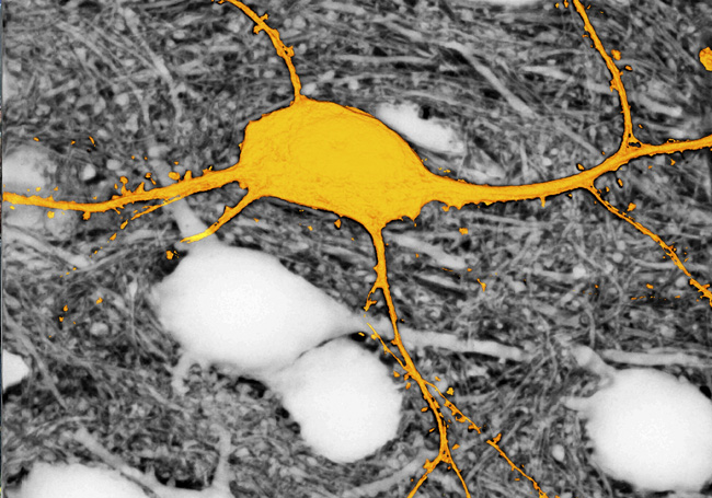 Imagen de la neurona etiquetada en amarillo, rodeada de neuronas no marcadas (aparecen en blanco), utilizando la técnica SUSHI. Sin esta técnica, las neuronas que aparecen en blanco no se verían.  © Jan Tønnesen & Valentin Nägerl.